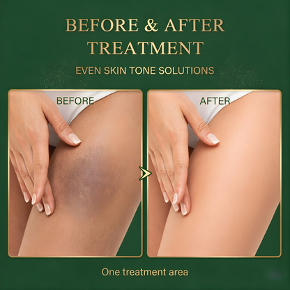 Dark Spot Brightening Cream for Underarms & Inner Thighs | PurelyCo